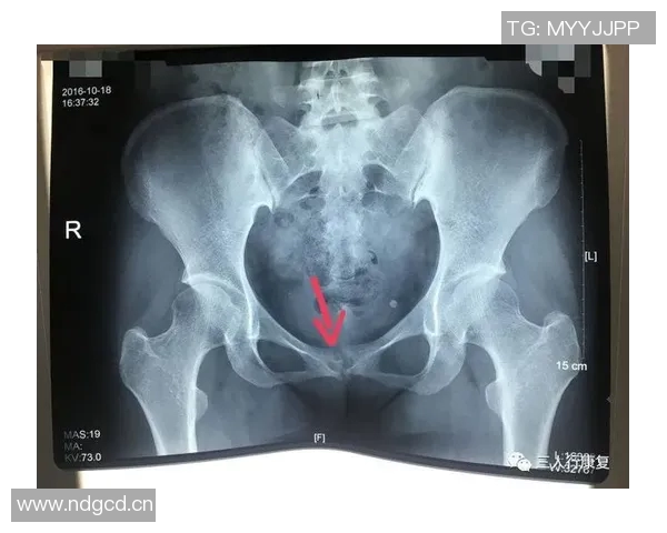 尼科威廉姆斯谈耻骨炎恢复过程并表示需带伤出战的挑战与决心